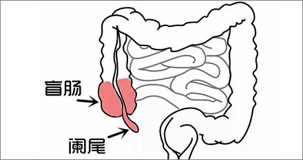 人类为什么要长阑尾？