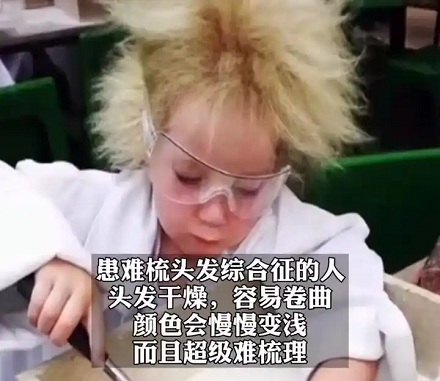 为什么爱因斯坦的头发总是乱糟糟的？