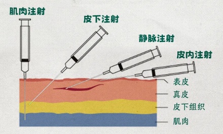 为什么小时候打针打在屁股上，长大却打胳膊？